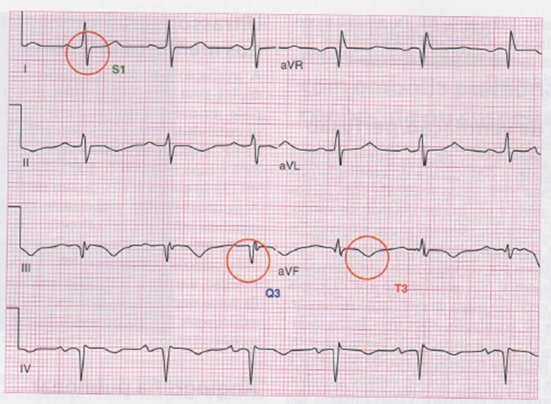 Imagem de Eletrocardiograma.